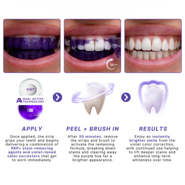 Purple Whitening Teeth Strips ~ Instantly brighten and balance yellow tones in 30 minutes.