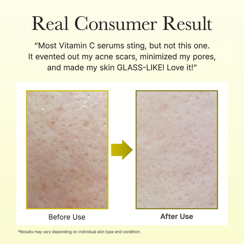 Vitamin C Booster Serum ~ Support glow by day and smoother skin at night.
