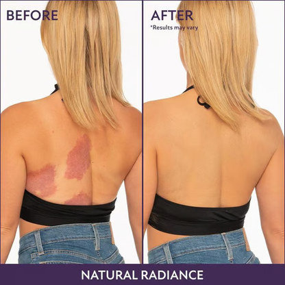 Body Coverage Perfector ~ This Cream Hides It ALL